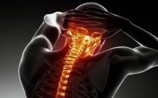 Остеохондроз — симптомы, причины, виды и лечение остеохондроза